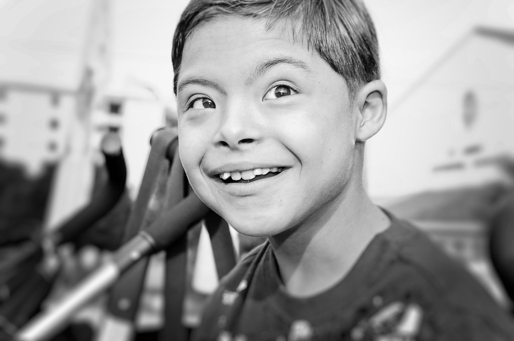 Japanese Scientists Found a Way to Remove Chromosome Responsible for Down Syndrome